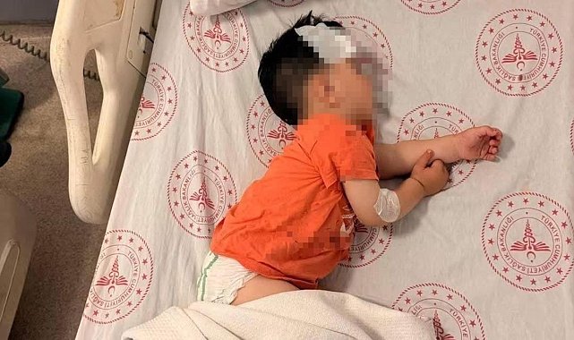 Sokak köpeklerinin saldırdığı 1 buçuk yaşındaki çocuk yaralandı
