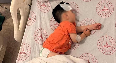 Sokak köpeklerinin saldırdığı 1 buçuk yaşındaki çocuk yaralandı